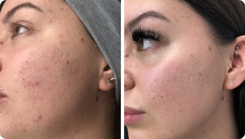 Martha M, 30